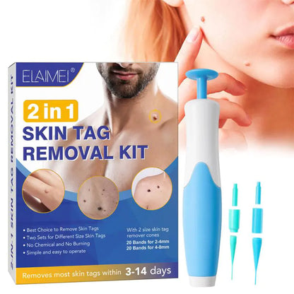 EpicShopPick™ 2-in-1 Skin Tag Remover Kit